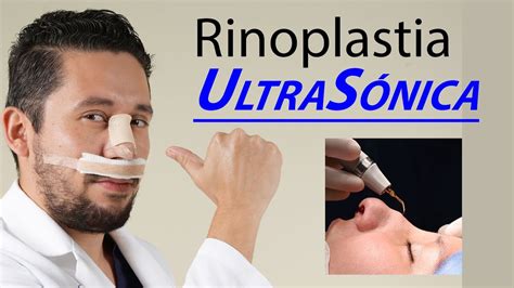 Rinoplastia Ultrasonica YouTube