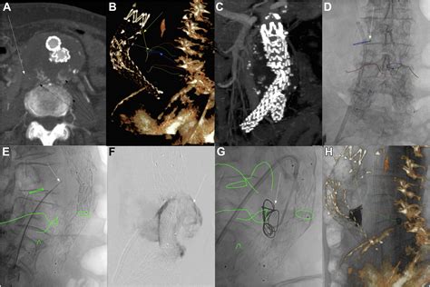 Image Guidance Techniques And Treatment Approach Optimization In The