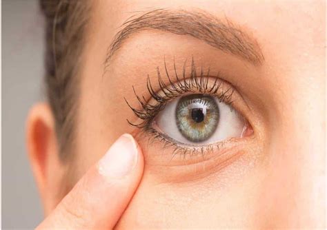 Ingrediente natural para clarear as olheiras e reduzir o inchaço nos olhos