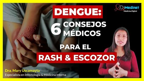 6 SOLUCIONES para TRATAR el RASH y PICAZÓN en la PIEL causado por el