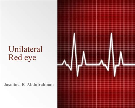 Techniques Of Tear Film Evaluation By Raju Kaiti