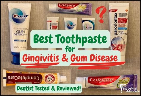 Five Toothpaste Brands