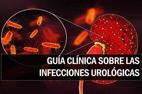 Gu A Cl Nica Sobre Las Infecciones Urol Gicas