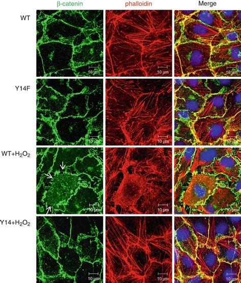 Immunofluorescent Staining Of B Catenin And F Actin In Rlmvecs