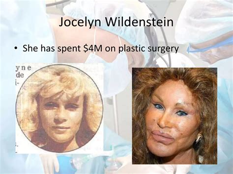 Plastic Surgery | PPTX