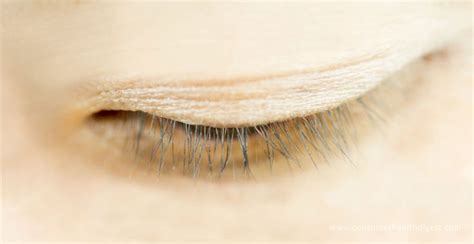 What Are Eyelash Mites, How do They Occur and How to Vanish Them?