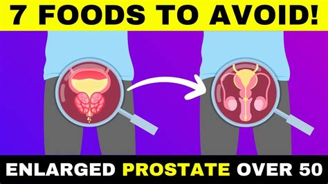 Foods To Avoid With An Enlarged Prostate Over Youtube