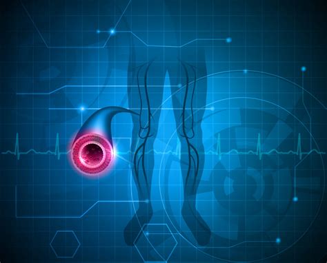 Peripheral Vascular Reconstruction Globehealer