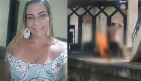 Morre Mulher Que Teve Corpo Incendiado Ex Marido Acusado De Crime