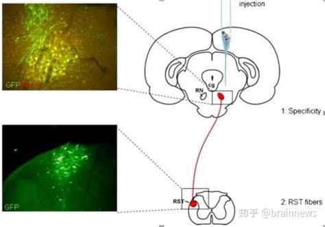 脑立体定位注射｜确认过眼神，这就是我要的技术文（初学者收藏） 知乎