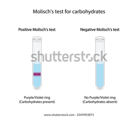 Molisch Test Over 2 Royalty Free Licensable Stock Vectors And Vector Art Shutterstock