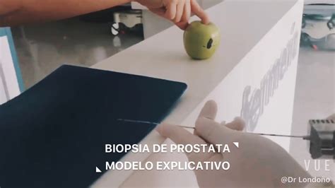 BIOPSIA DE PROSTATA MODELO EXPLICATIVO YouTube