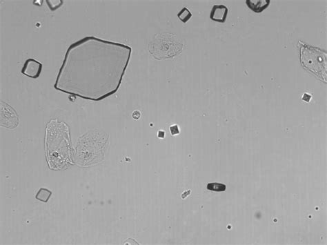 Pin On Uric Acid