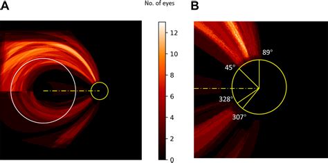 Retinal Nerve Fiber Layer Optical Texture Analysis Ophthalmology