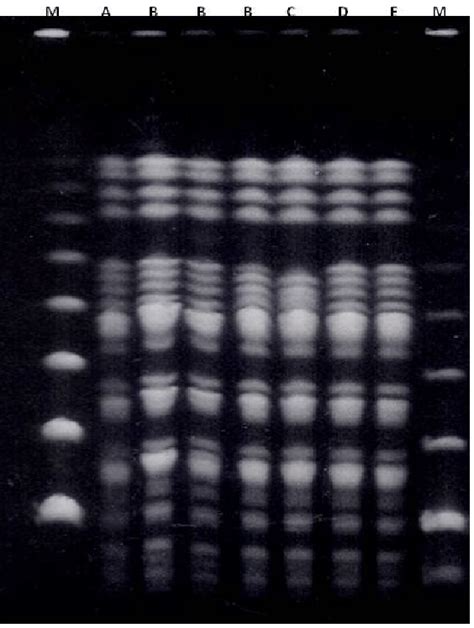 PFGE patterns obtained of different insolated from C. freundii E9750 in ...