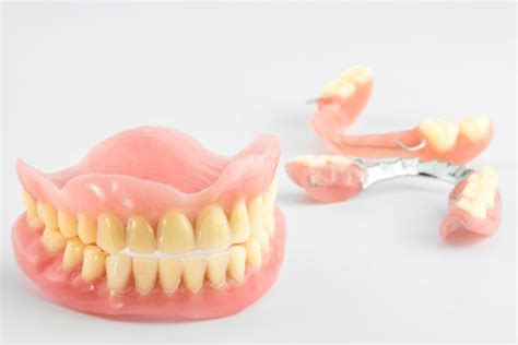 Pr Tesis Dental Removible Es Una Buena Opci N Para Ti Cl Nica