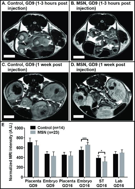 Representative Slices Of Fat Normalized T 2 Weighted MRI Scans Of