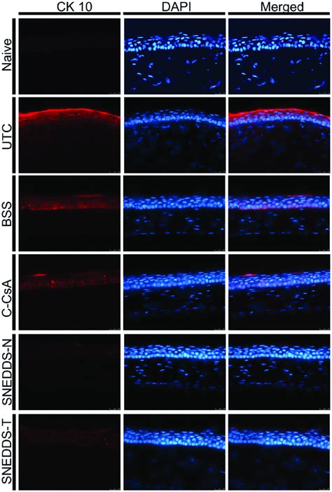 Representative Images For Immunofluorescent Staining Of Ck 10 In