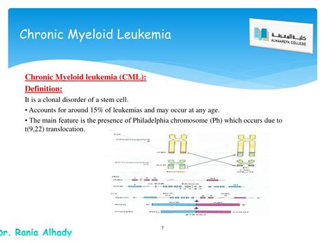 Ppt Chronic Leukemia Powerpoint Presentation Free Download Id 1434345