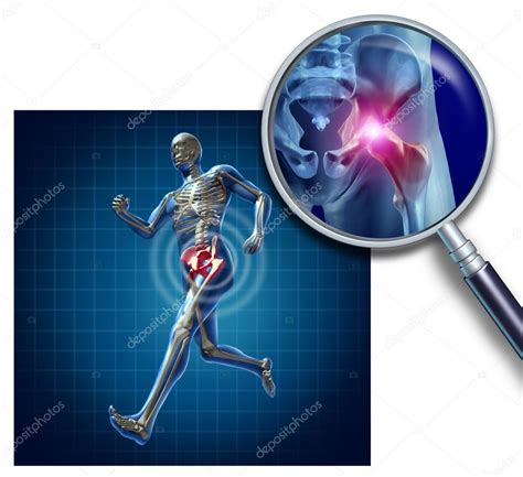 Sports Hip Injury — Stock Photo © Lightsource 12204177