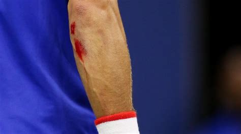 Novak Djokovic así fue la aparatosa caída que le causó heridas