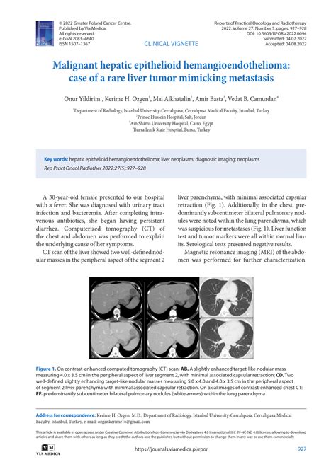 PDF Malignant Hepatic Epithelioid Hemangioendothelioma Case Of A