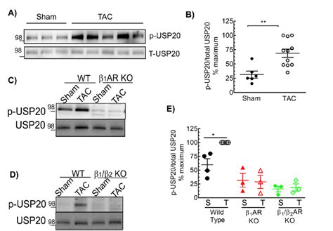 Cardiac Pressure Overload Induces Usp Phosphorylation In A