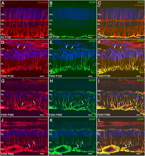 Frontiers Astrocytes And M Ller Cell Alterations During Retinal