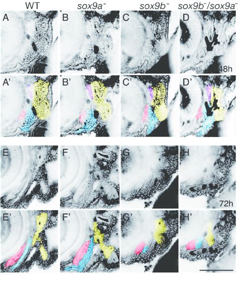 Differential Functions Of Sox Duplicate Genes In The Morphogenesis And