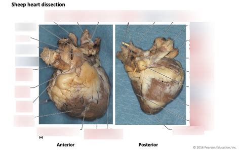 Sheep Heart Diagram Quizlet