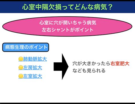 心室中隔欠損症を解説！症状のメカニズムをイラストで紹介〜看護師国家試験対策〜