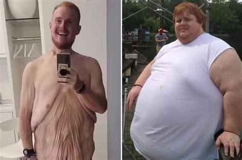 Obese Reality Star Casey King Loses Pounds In Life Changing