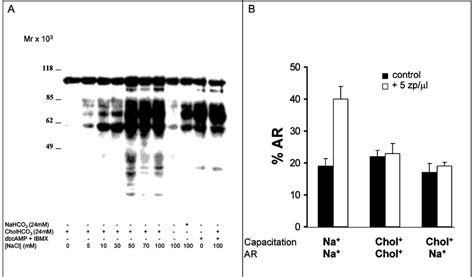 Capacitation And Capacitation Associated Increase In Protein Tyrosine