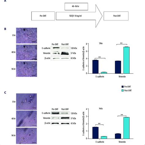 Tgf B 1 Induces Emt In Cervical Cancer Cells A Schematic Download Scientific Diagram