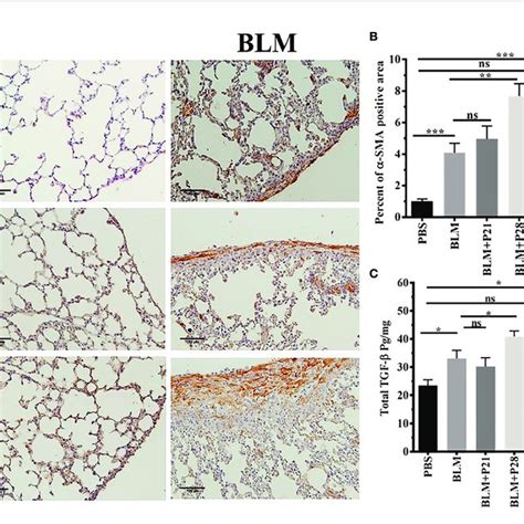 Progesterone Increases Expression Of A Sma And Tgf B In Fibrotic Lung