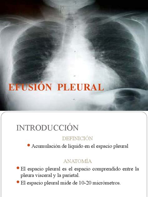 EfusiÓn Pleural Final Tórax Anatomía Humana Medicina