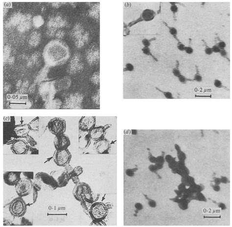 Electron Micrographs Of Phage A Negatively Stained With