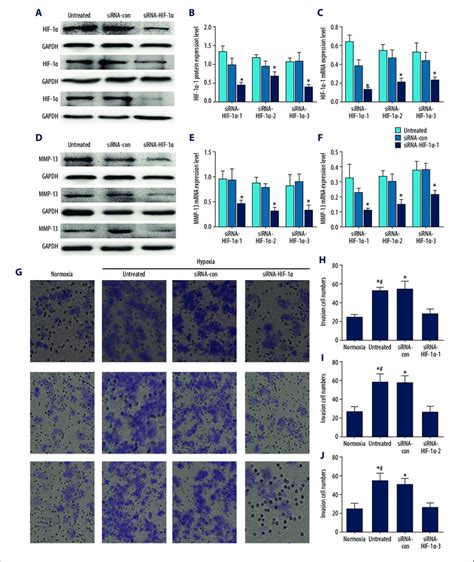 siRNA transfection and Transwell migration assay. (A, B) Western blot ...