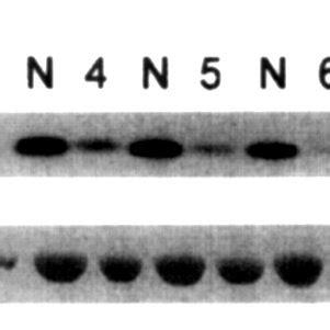 Immunoblot Analysis Of Muscle Biopsies From Complete And Partial