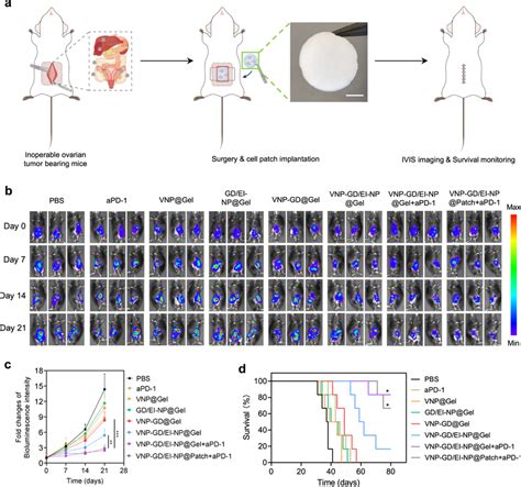 Antitumor Efficacy Of Implantable Cell Patch In Inoperable Ovarian