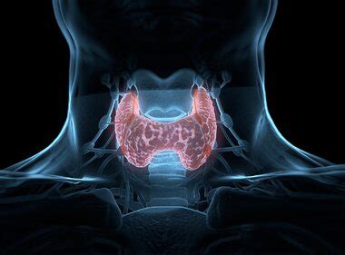 Brzuch tarczycowy jak się objawia i czy może zniknąć Zdrowie Wprost