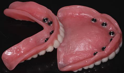 Dentures Masood Cajee Dds Mph