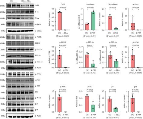 4 Pba Treatment Inhibits Emt Er Stress And Cellular Senescence In