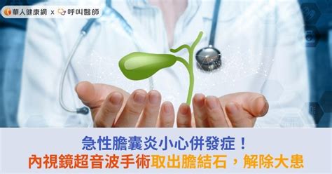 急性膽囊炎小心併發症！內視鏡超音波手術取出膽結石，解除大患 華人健康網 專業即時優質的健康新聞及資訊分享平台業即時優質的健康新聞及資訊分享平台