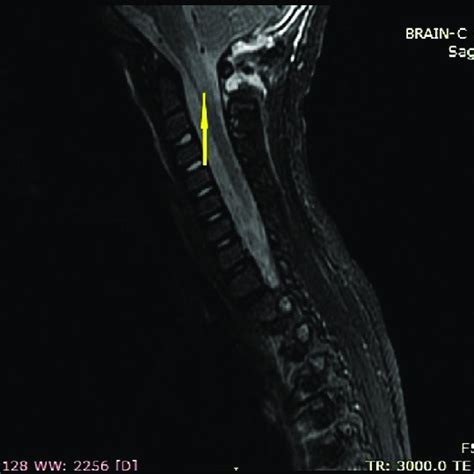 Surgical procedures in RASPA surgery (details in reference 18). A ...