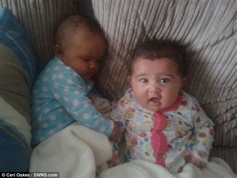 These Twins Have The Same DNA But Different Skin And Eye Colors. How ...