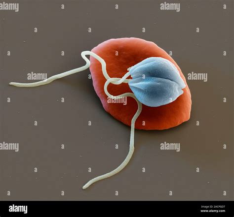 Leishmania Protozoa And Blood Cell Coloured Scanning Electron