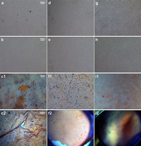 Corneal Endothelial Cell Morphology Photographs Of The Corneal