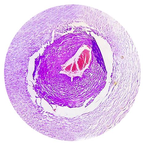 Artery And Vein Slide Archives American Scientific