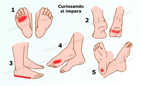 Tipi Di Dolori Alla Pianta Del Piede E Come Migliorare I Sintomi